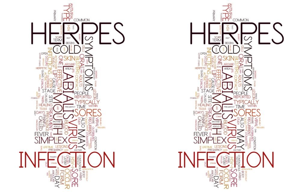 komplikasi herpes genital