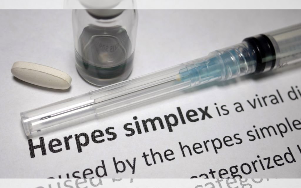 metode pengobatan jenis herpes kelamin