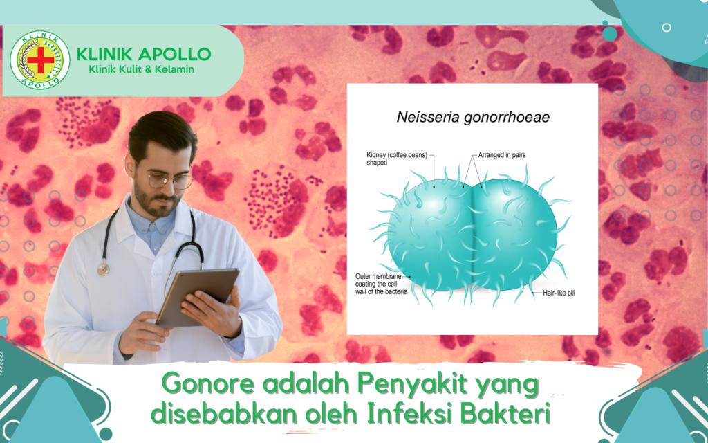 Gonore adalah Penyakit yang disebabkan oleh Infeksi Bakteri