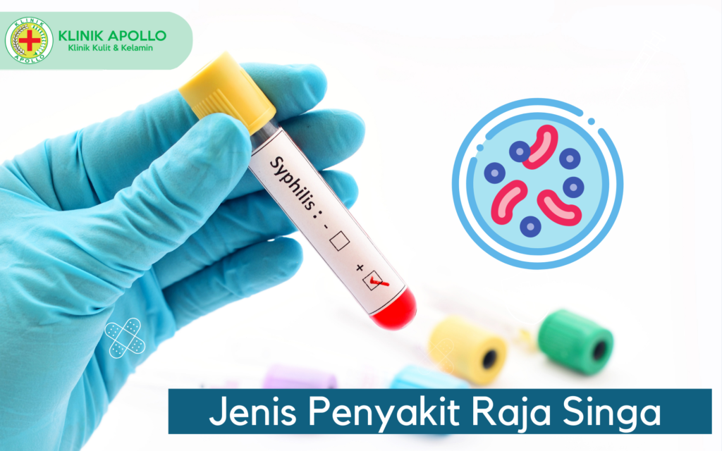 Jenis Penyakit Raja Singa