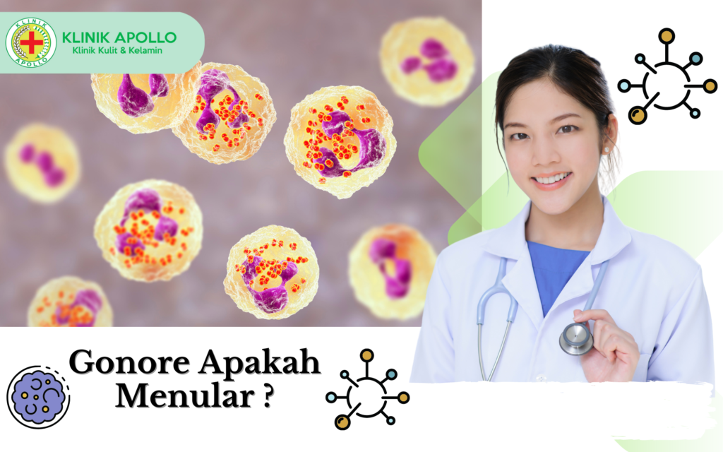 Gonore Apakah Menular