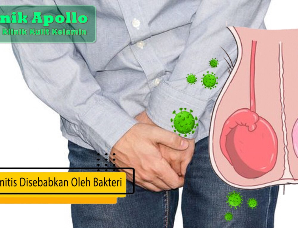 Ketahui Apa Saja Pantangan Epididimitis Pria Klinik Apollo Jakarta