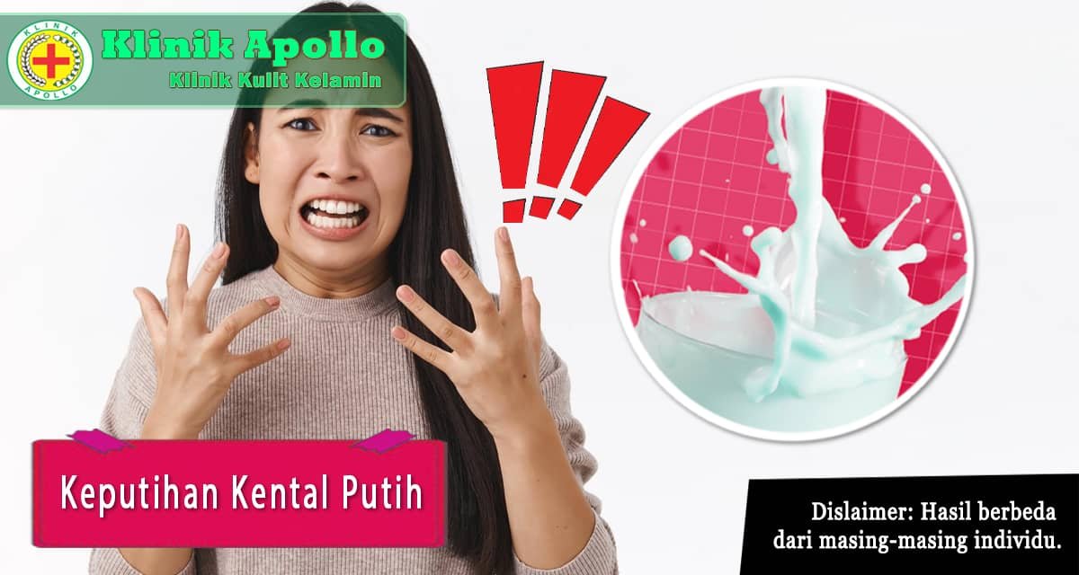 Keputihan Kental Putih Pada Wanita Dan Cara Mengobatinya Klinik