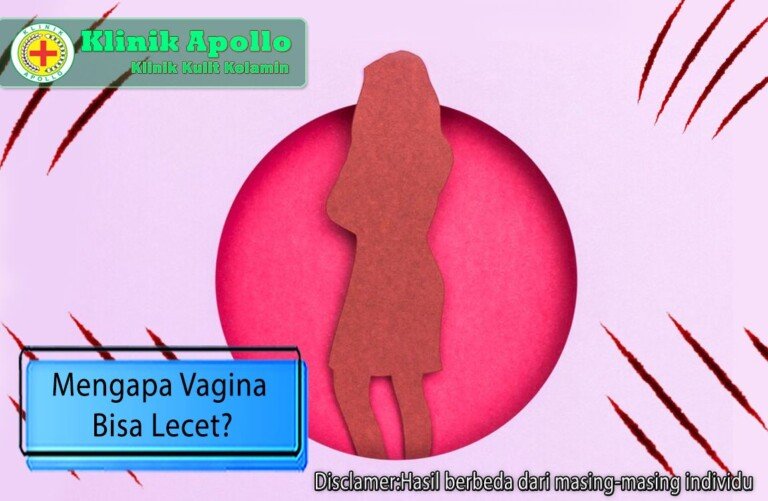 Vagina Lecet Menyiksa Inilah Penyebab Dan Cara Mencegahnya Klinik