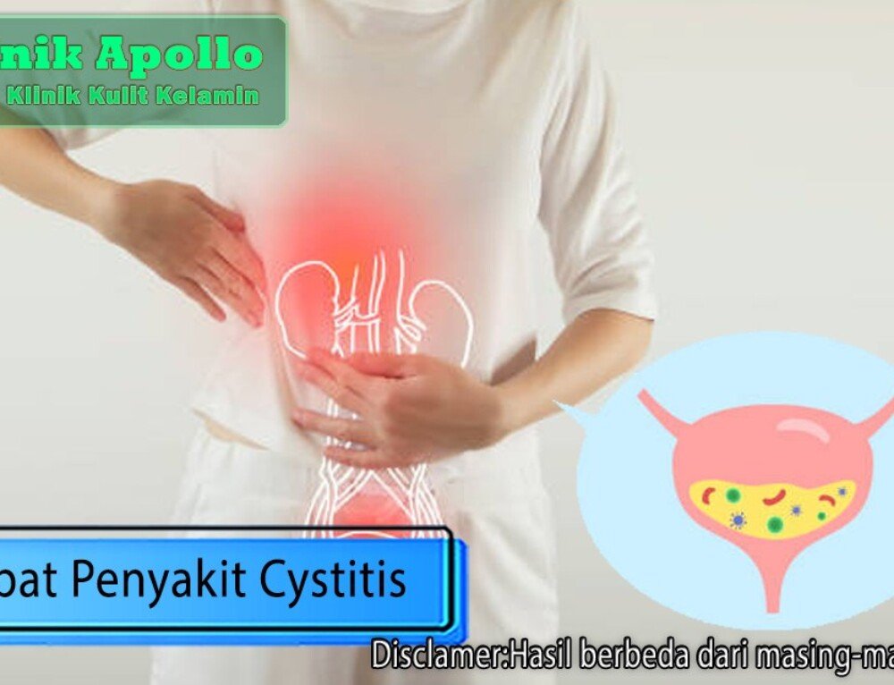 Dampak Penyakit Menular Seksual Bisa Mengancam Jiwa Klinik Apollo