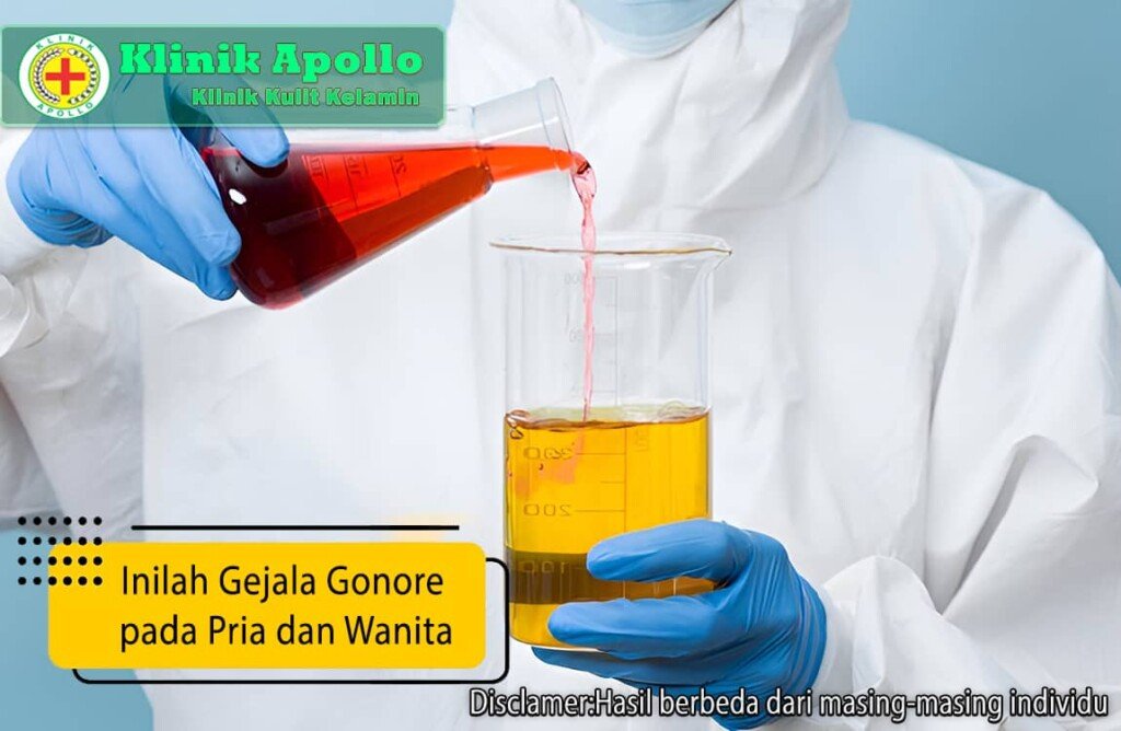 6 Gejala Awal Gonore Wajib Diwaspadai Intip Penanganannya Klinik