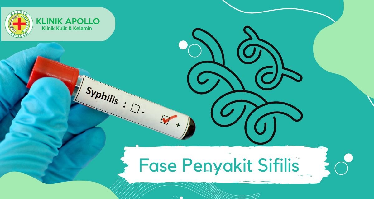 Fase Penyakit Sifilis