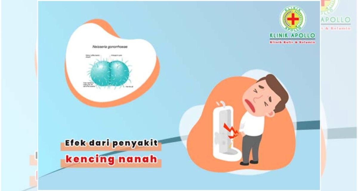 mengatasi efek dari kencing nanah