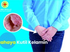 Bahaya kutil kelamin