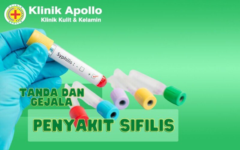 Cara Mengobati Sifilis Dengan Tepat Simak Disini Klinik Apollo Jakarta