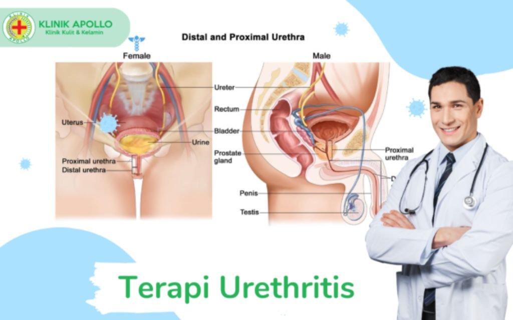 cara penanganan penyakit urethritis