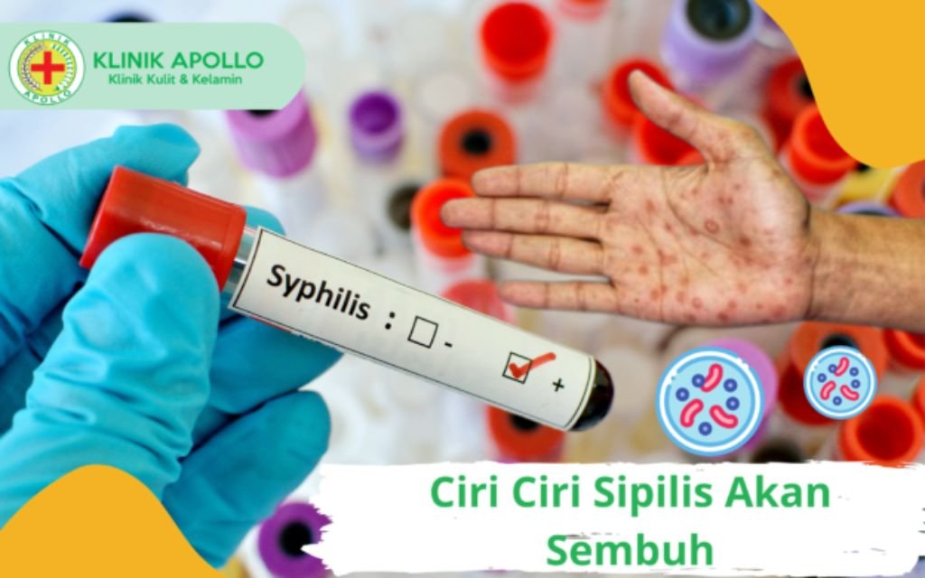 sipilis bisa sembuh