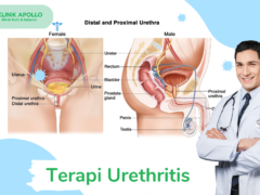 Terapi Urethritis - klinik apollo