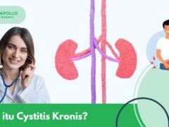 Apa itu Cystitis Kronis