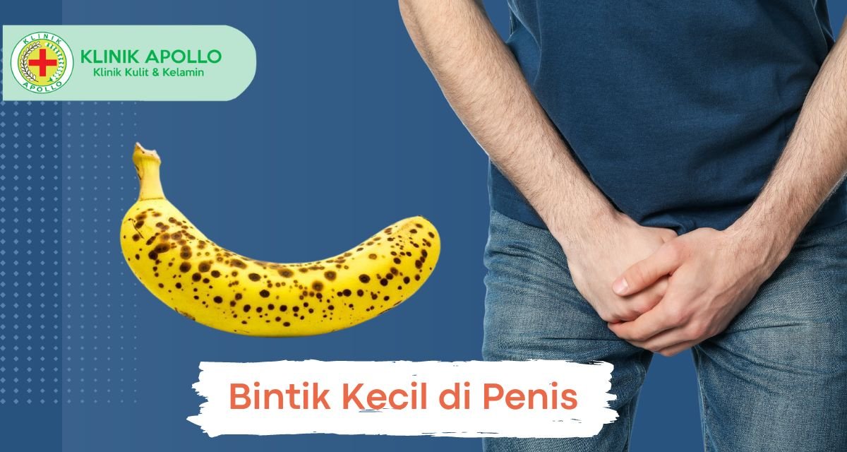Bintik Kecil di Penis