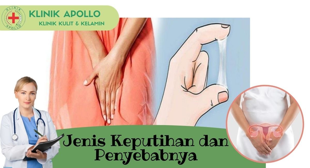 Jenis Keputihan dan Penyebabnya