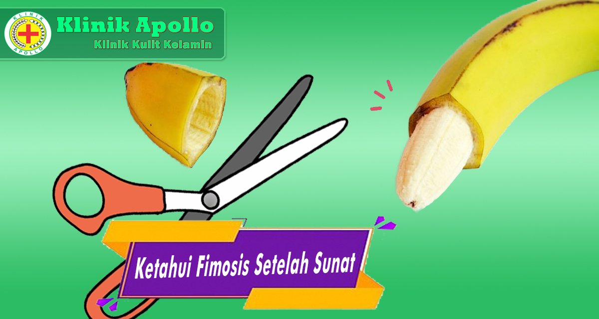 Ketahui Fimosis Setelah Sunat