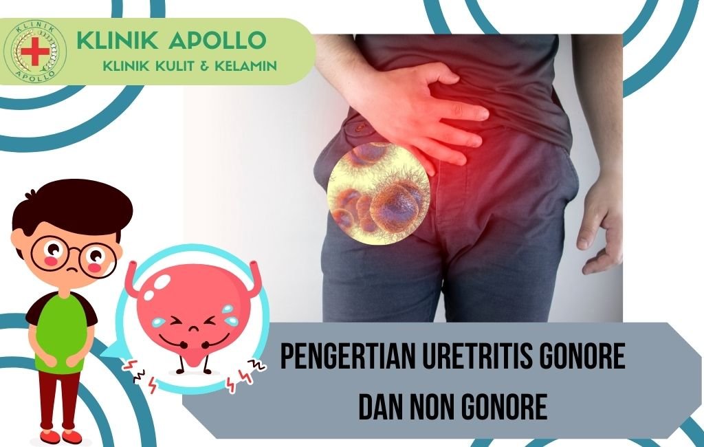 Pengertian Uretritis Gonore dan Non Gonore