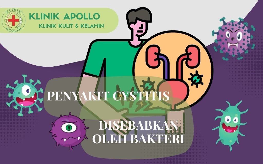 Penyakit Cystitis Disebabkan Oleh Bakteri