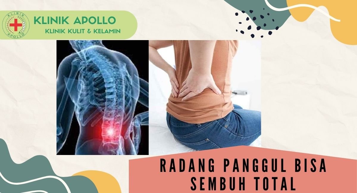 Ilustrasi Radang Panggul Bisa Sembuh Total