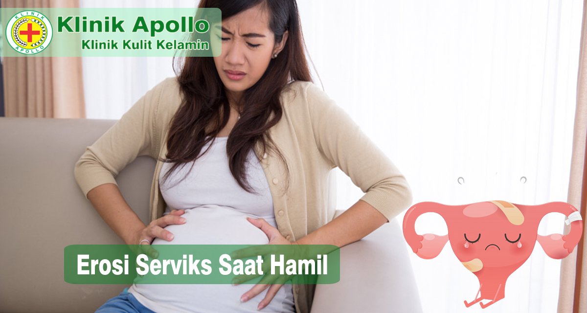 Ilustrasi Erosi Serviks Saat Hamil