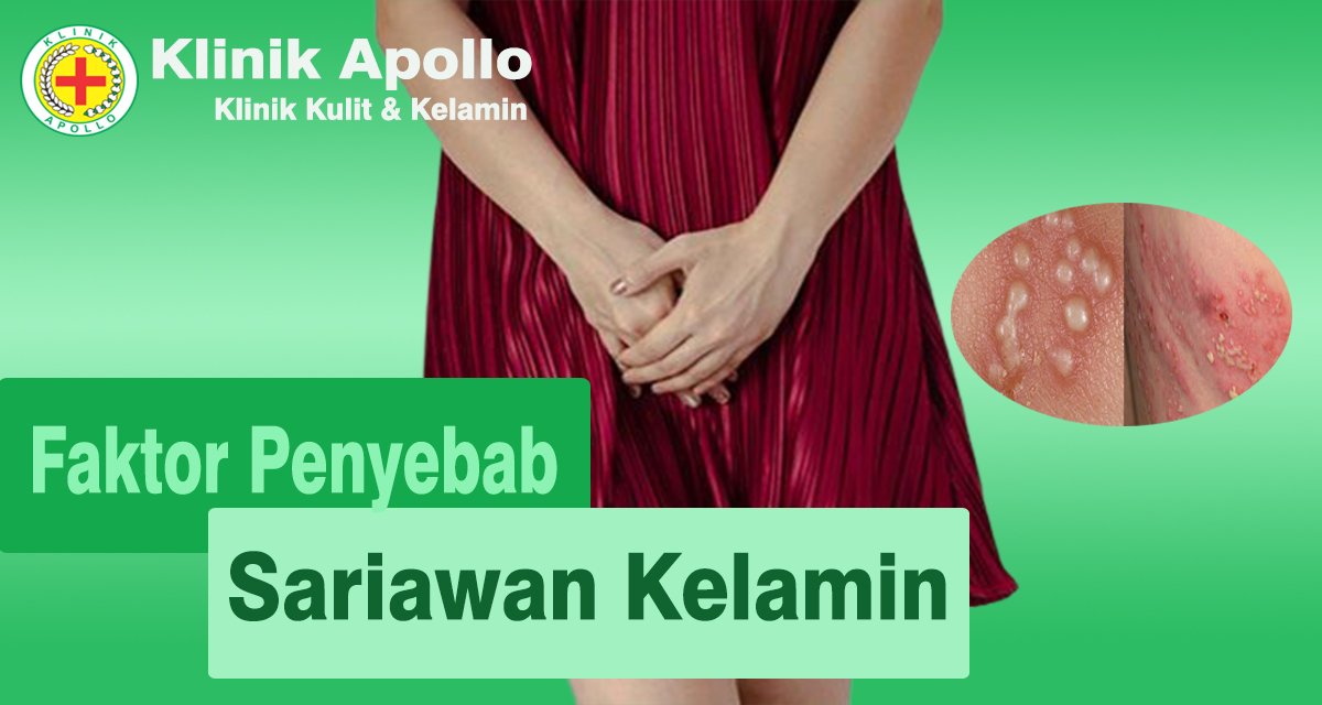 Faktor Penyebab Sariawan Kelamin
