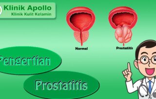 Pengertian Prostatitis