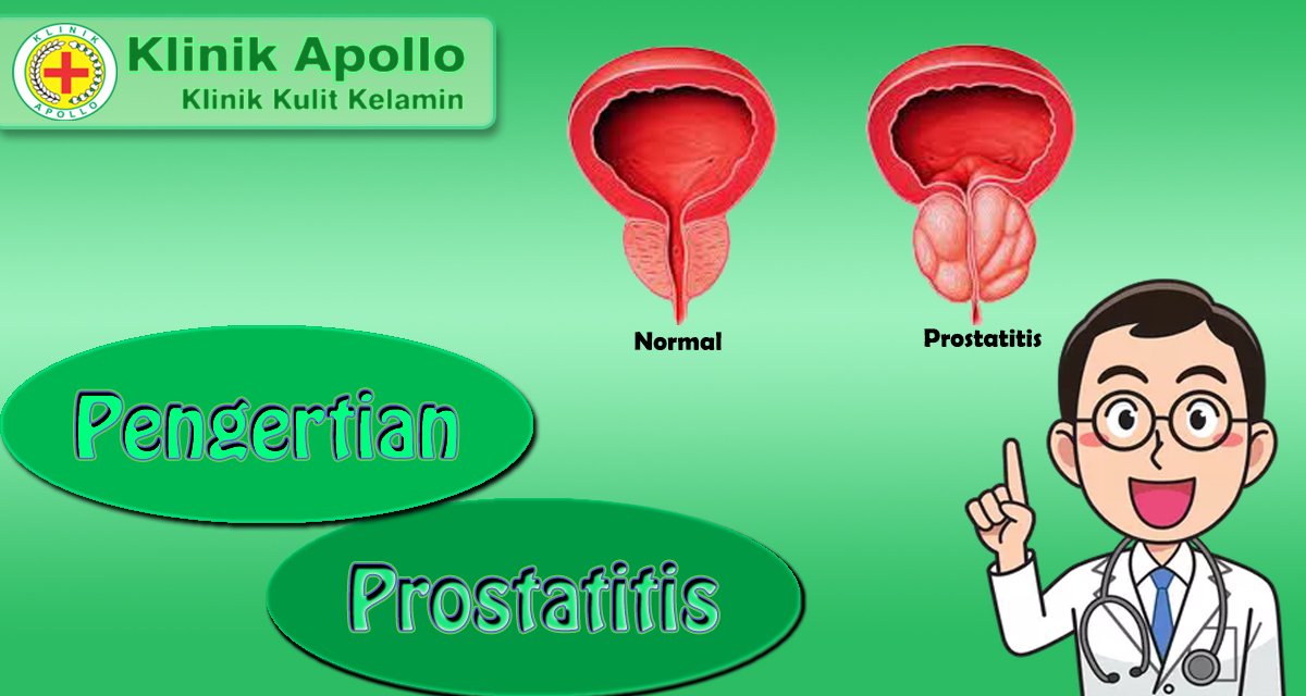 Pengertian Prostatitis