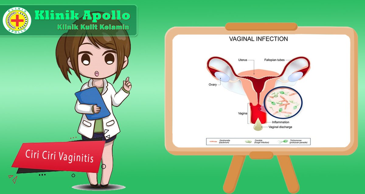Ketahui ciri ciri vaginitis yang paling umum.