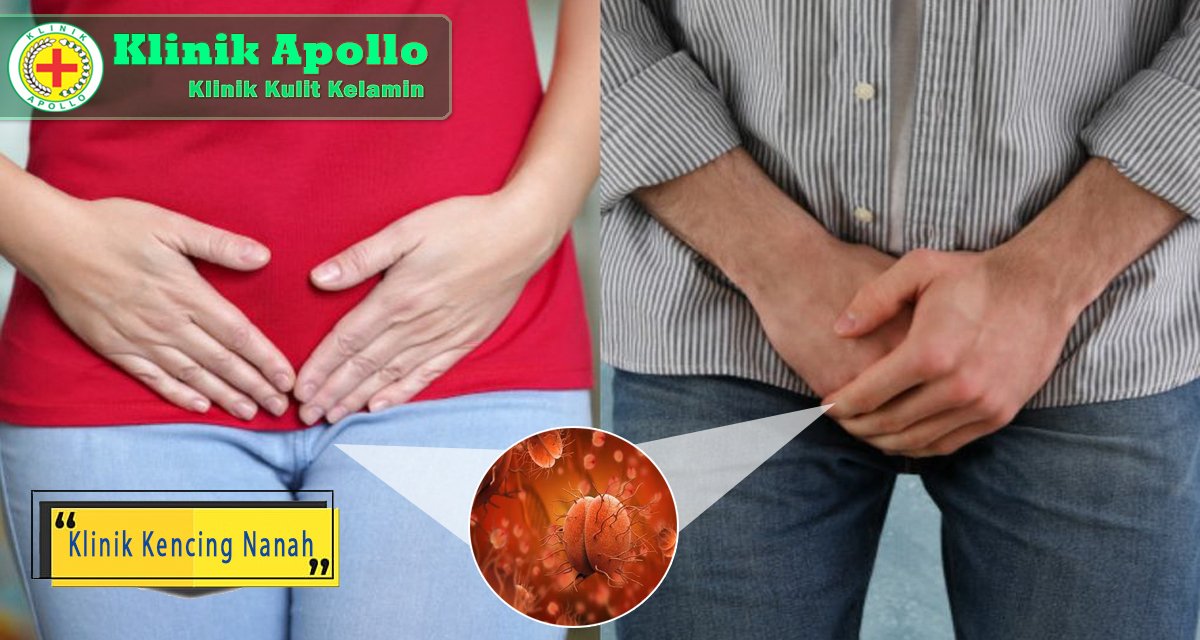 Bakteri penyebab kencing nanah yang tidak diobati dapat menyebabkan infertilitas.