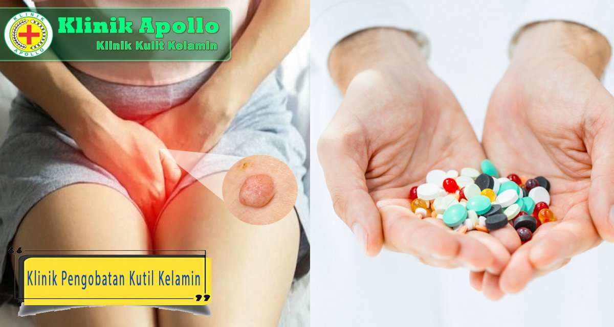 Kutil kelamin dapat disembuhkan di Klinik Apollo Jakarta.