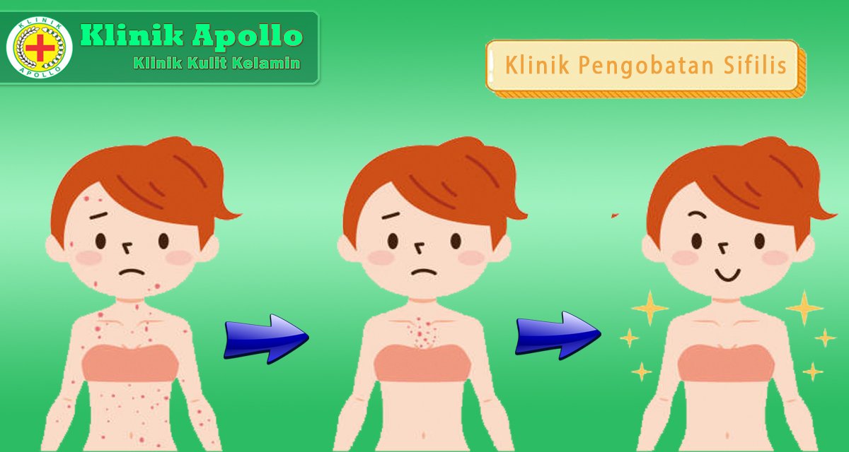 Sifilis dapat disembuhkan dengan pengobatan sejak dini.