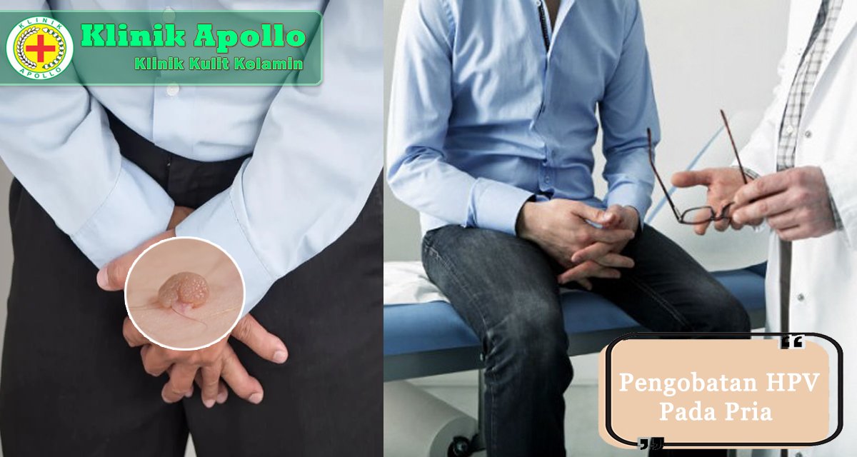 Obat HPV Untuk Pria