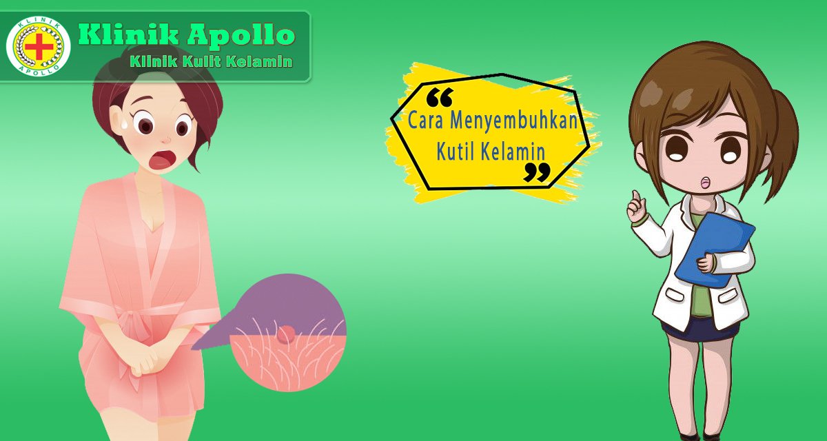 Kutil kelamindapat dengan mudah disembuhkan dengan melakukan pengobatan yang tepat.