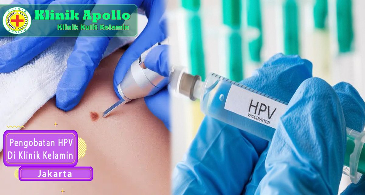 HPV bisa ditangani jika dilakukan penanganan dengan cepat dan tepat di Klinik Apollo.