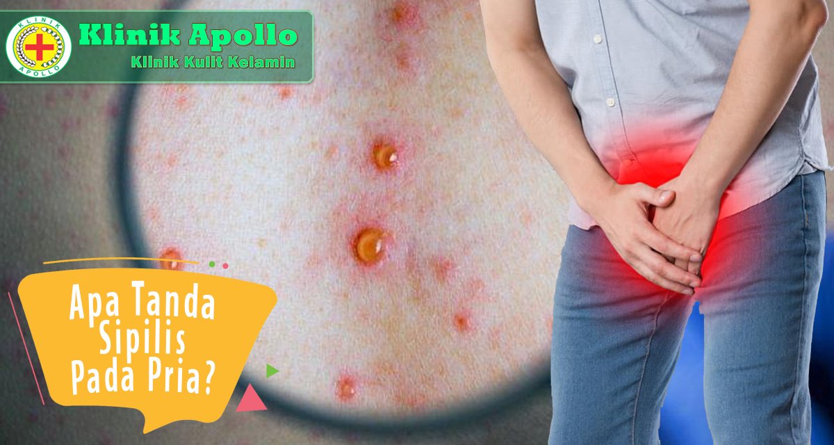 Apa Tanda Sipilis Pada Pria
