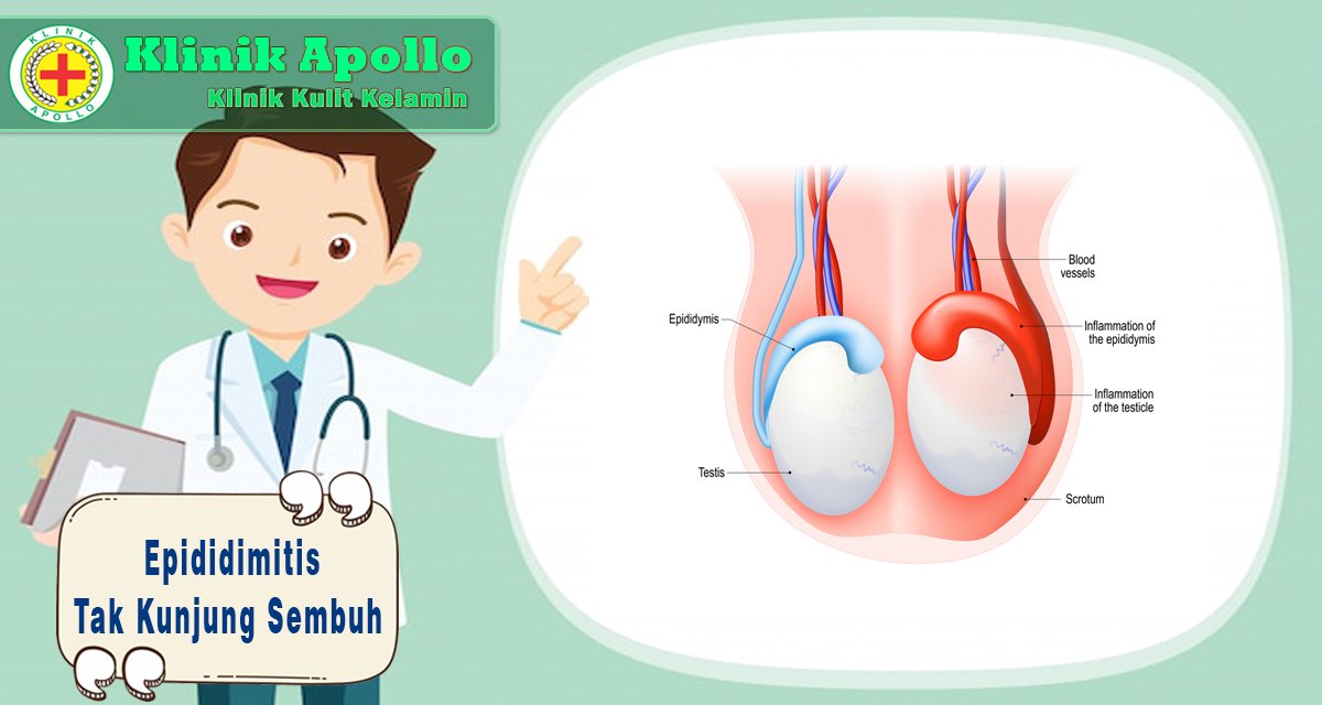 Epididimitis Tak Kunjung Sembuh