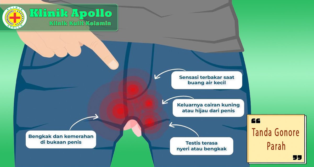 Pengobatan gonore dilakukan oleh dokter ahli di Klinik Apollo.