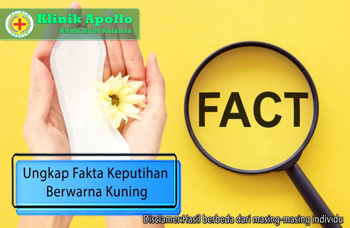 Ilustrasi Fakta Keputihan Berwarna Kuning