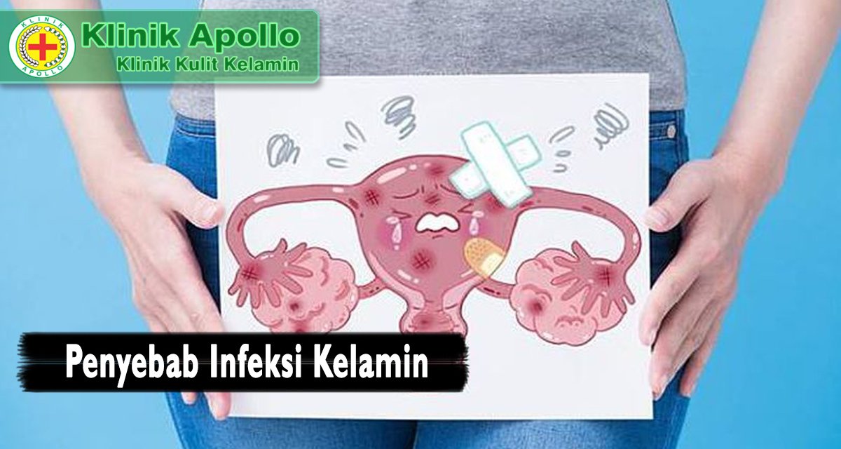 infeksi kelamin