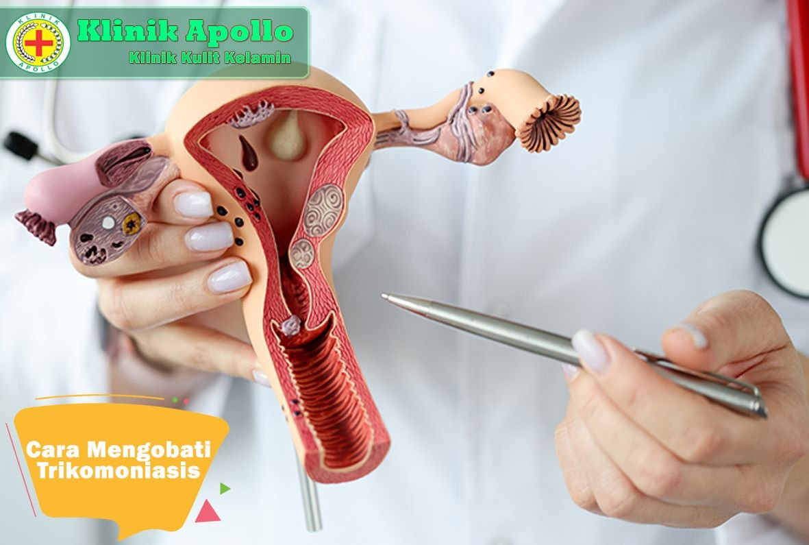 Cara tepat mengobati trikomoniasis dengan pengobatan yang tepat di klinik.