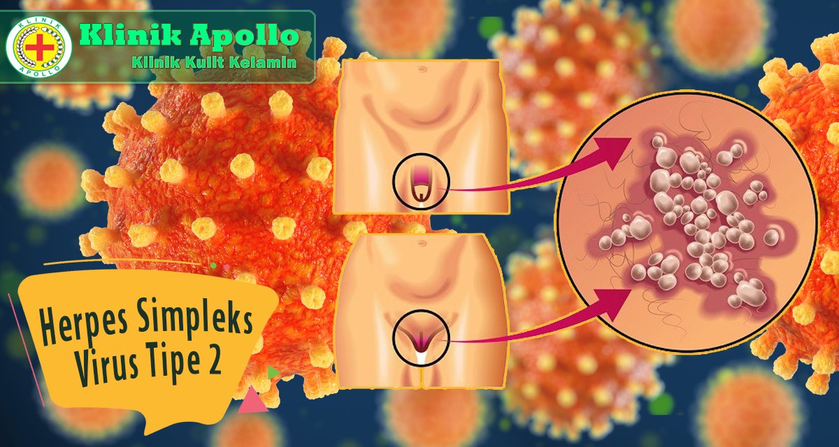 Segera hubungi dokter untuk mendapatkan penanganan lebih lanjut.