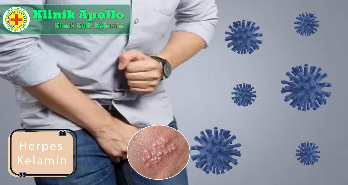 Segera hubungi dokter untuk melakukan pengobatan herpes kelamin di Klinik Apollo.