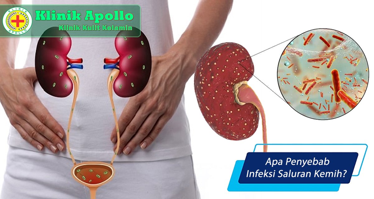 Apa Penyebab Infeksi Saluran Kemih Klinik Apollo Jakarta