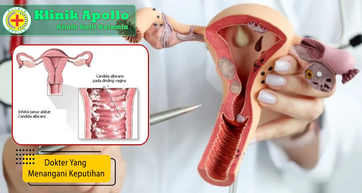 Spesialis dokter yang menangani keputihan bisa ditemui di Klinik Apollo.