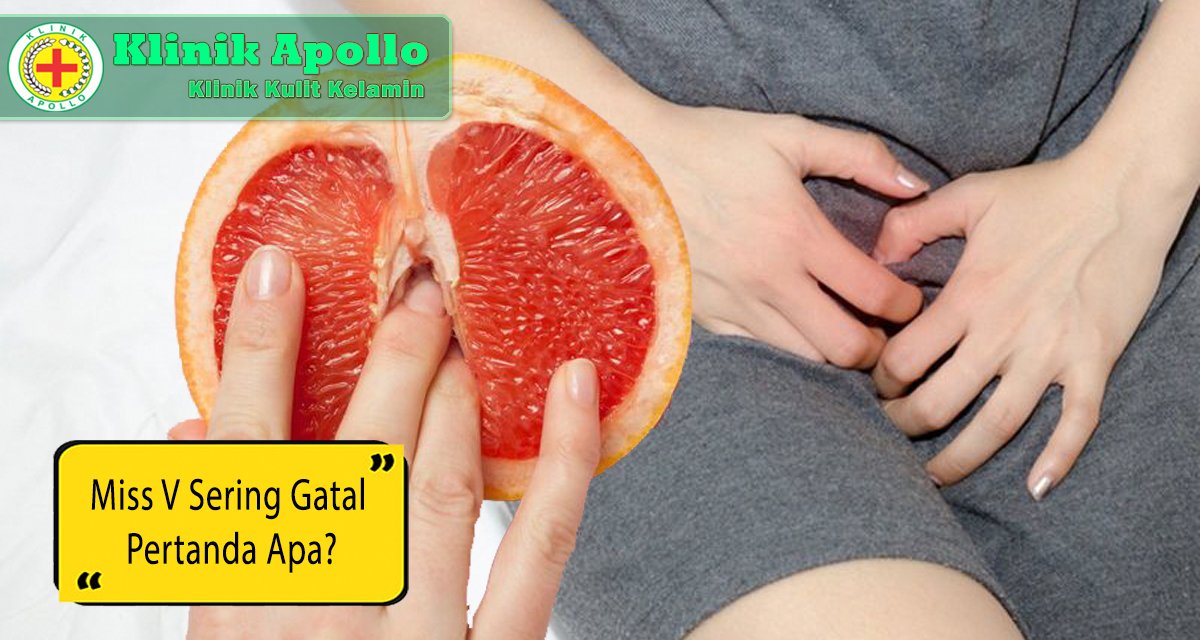 Selalu hubungi dokter spesialis untuk penanganan miss v gatal.
