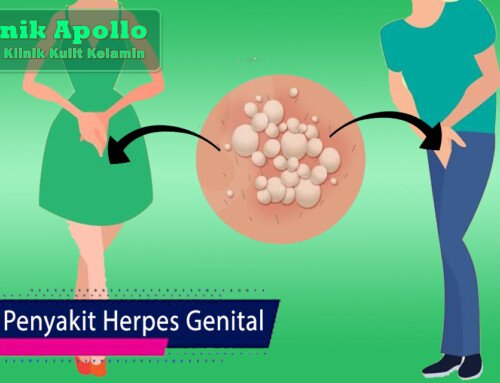 Klinik Khusus Penyakit Herpes Genital Jakarta Pusat