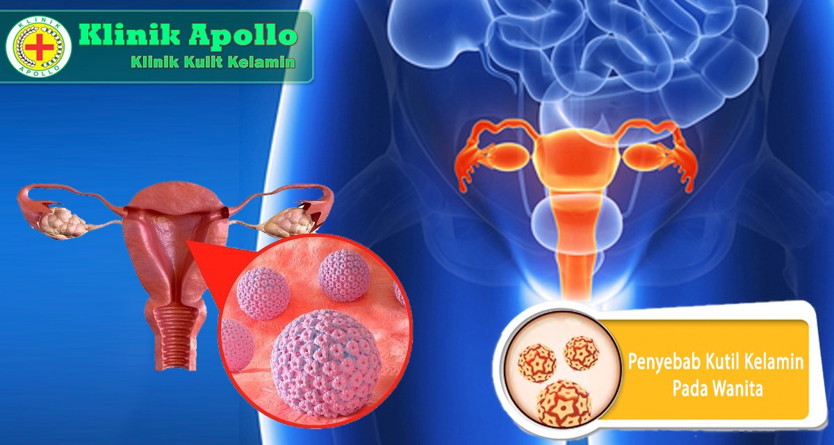 Tentukan penyebab kutil kelamin pada wanita dengan pemeriksaan di Klinik Apollo.