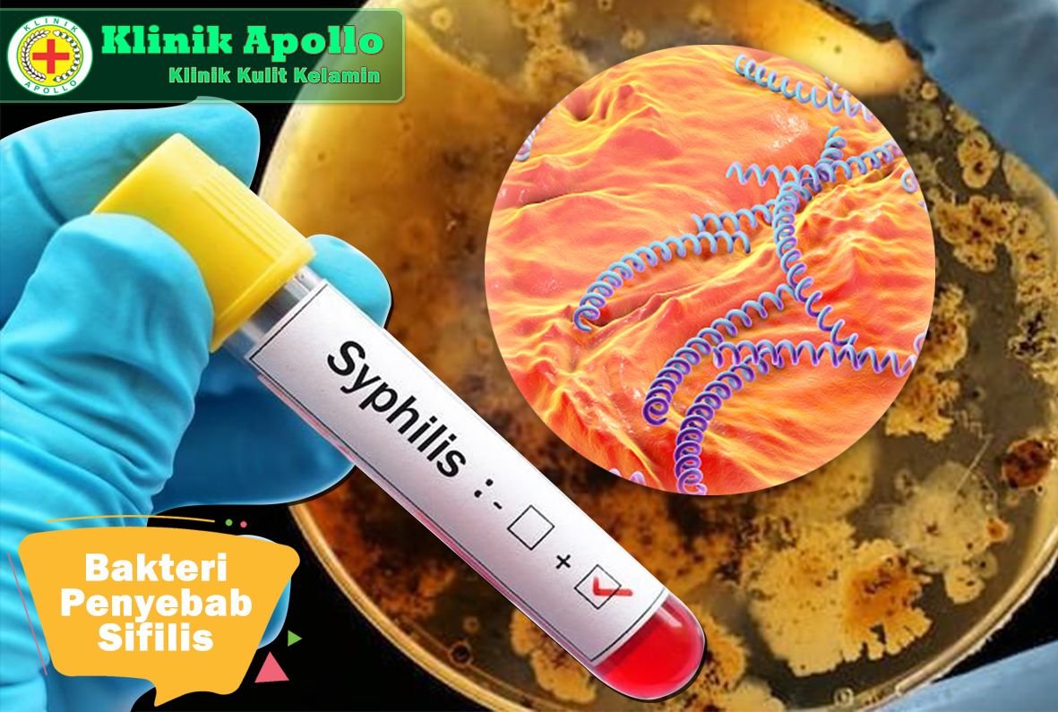 Bakteri Penyebab SIfilis