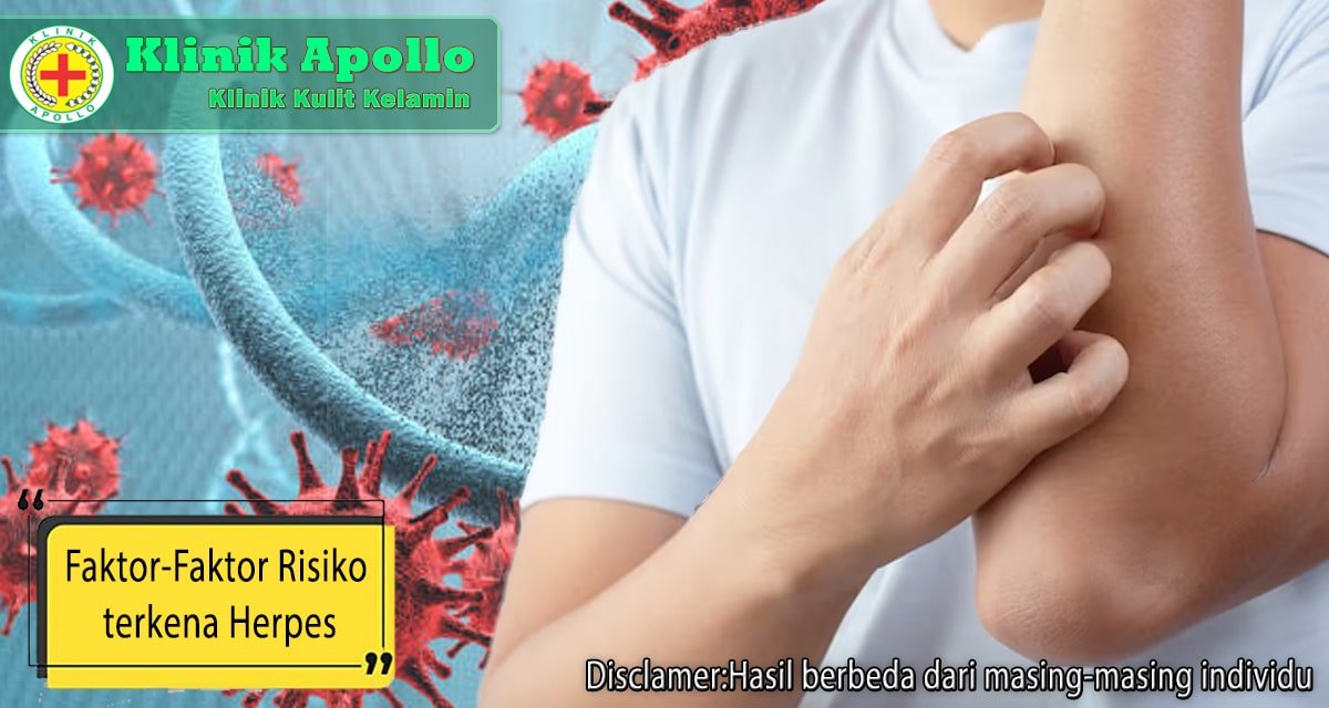 Hubungi dokter ahli untuk penanganan semua faktor risiko herpes.